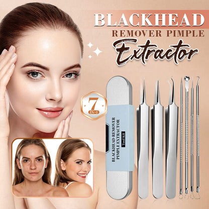 💓Ultima zi 50% OFF💥Stainless Steel Blackhead Remover Tool Kit
