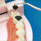 🦷Set de scobitori din oțel inoxidabil💯