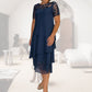 🔥[S-3XL]💃Rochie din dantelă asamblată